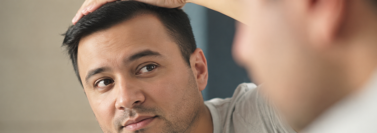 Guide to male pattern baldness, including a receding hairline, thinning crown and treatment options