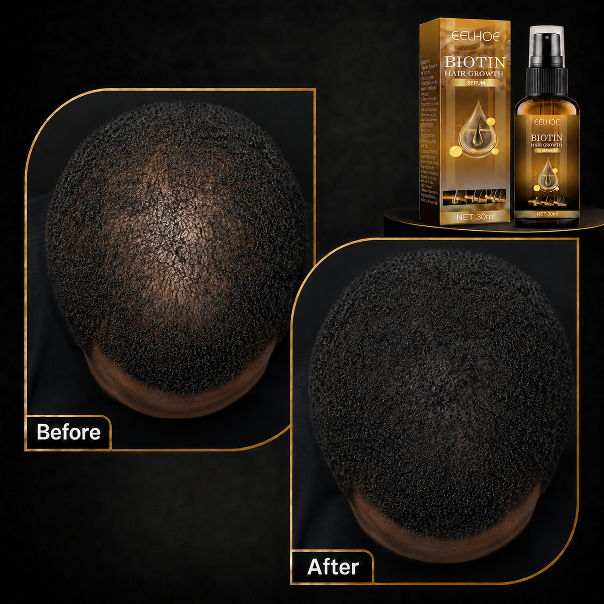 Hair Growth Biotin Spray – Prevents Baldness, Repairs Scalp & Thickens Hair
