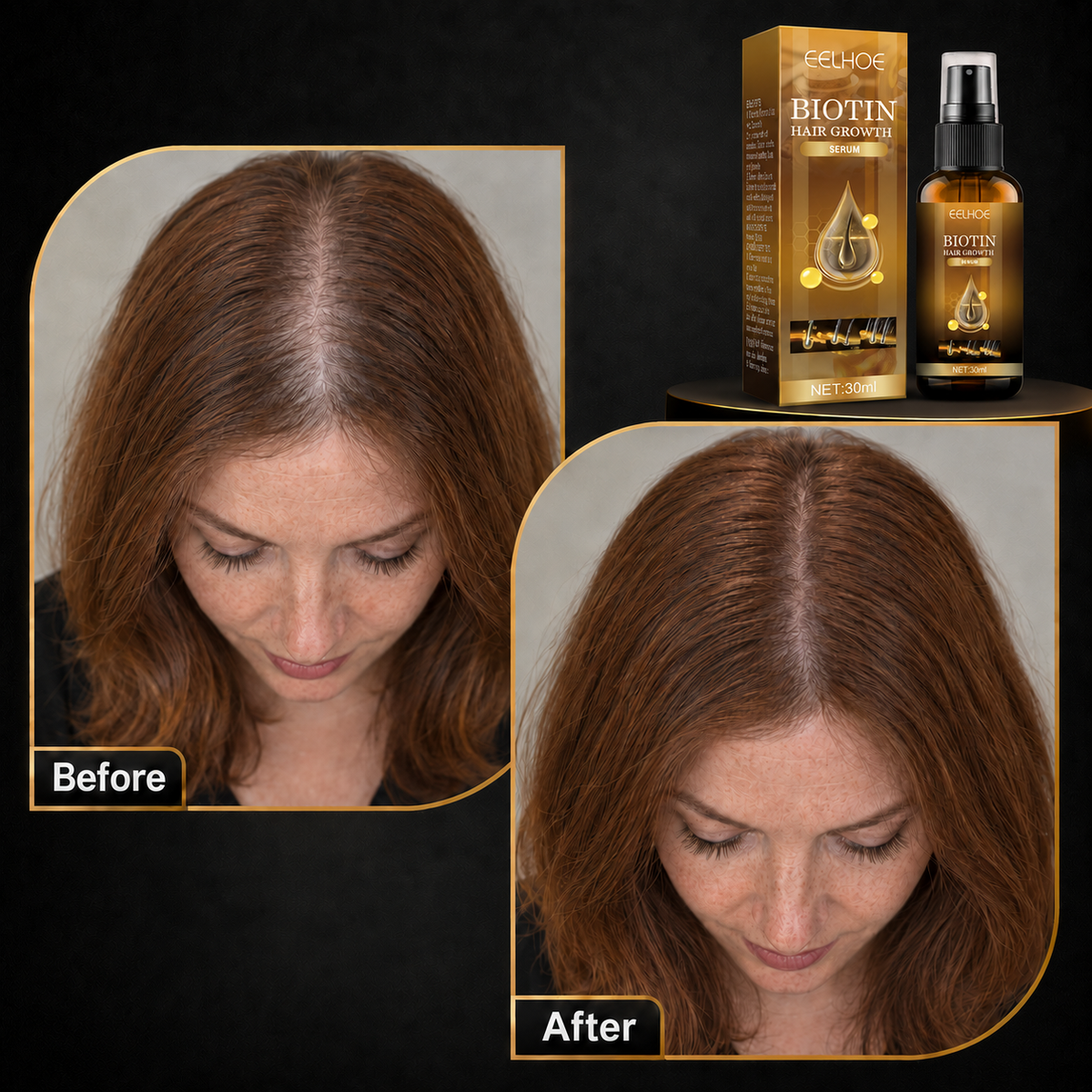 Hair Growth Biotin Spray – Prevents Baldness, Repairs Scalp & Thickens Hair